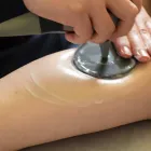 むくみ